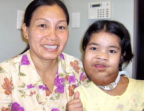 Аномальные дети чаще всего рождаются в Азии