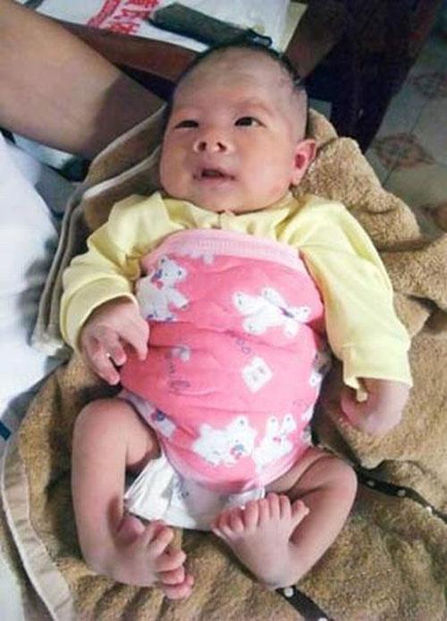 Аномальные дети чаще всего рождаются в Азии