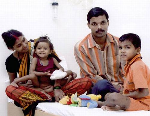 Аномальные дети чаще всего рождаются в Азии