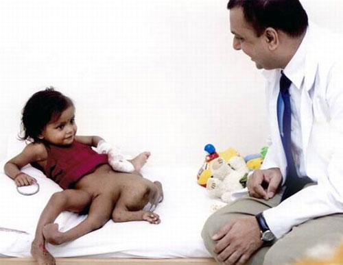 Аномальные дети чаще всего рождаются в Азии