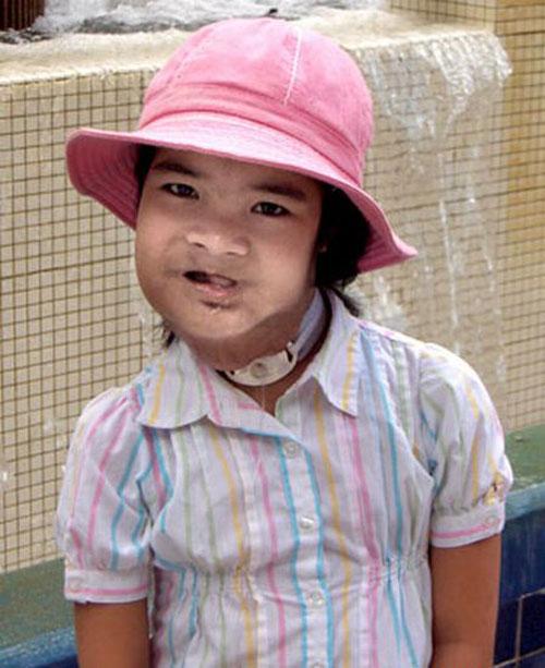 Аномальные дети чаще всего рождаются в Азии