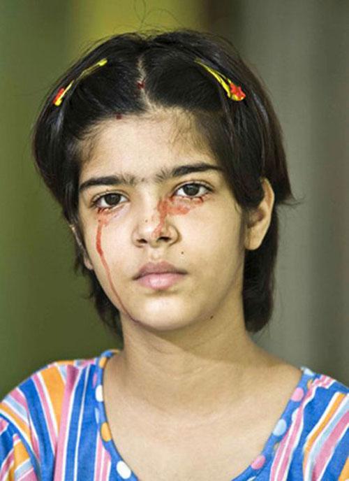 Аномальные дети чаще всего рождаются в Азии