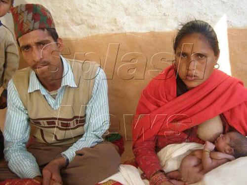 Аномальные дети чаще всего рождаются в Азии