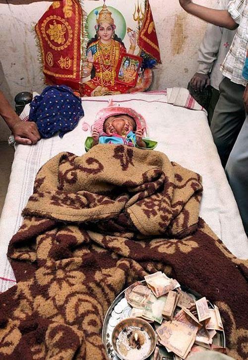 Аномальные дети чаще всего рождаются в Азии