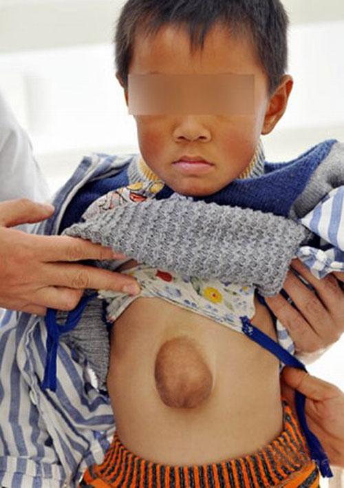 Аномальные дети чаще всего рождаются в Азии