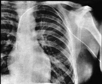 Топ-20 самых необычных экспериментов в истории