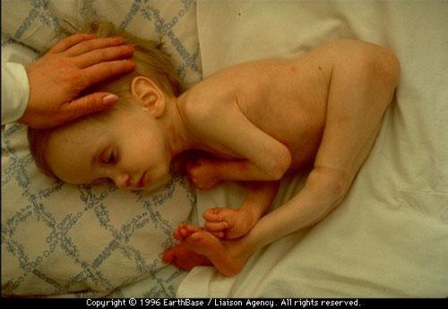 Мутанты Чернобыля: страшные последствия аварии на Чернобыльской АЭС