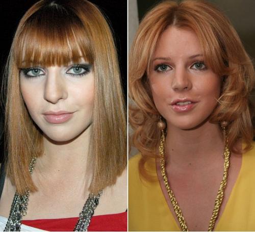 Звездные носы: дар природы или работа мастера?