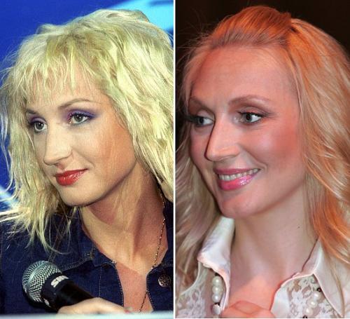 Звездные носы: дар природы или работа мастера?