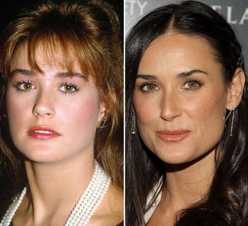 Звездные носы: дар природы или работа мастера?