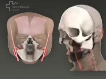 Пациент с пересаженным лицом показался на публике