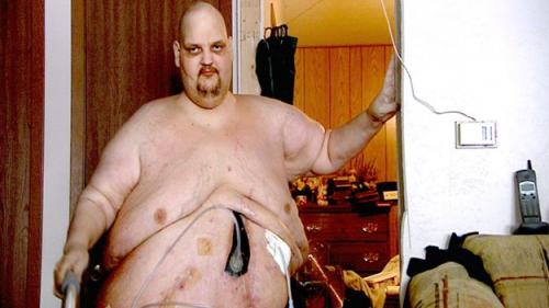 Фантастическое похудение Патрика Дюэля