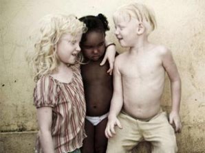 У чернокожих родителей родилось трое детей-альбиносов