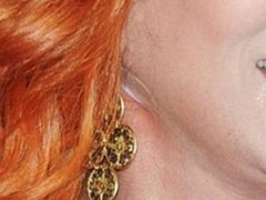 Шер сделала подтяжку лица пластырем