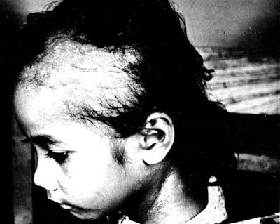 Самые злые эксперименты над человеком