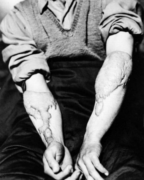 Хиросима и Нагасаки: шокирующие кадры