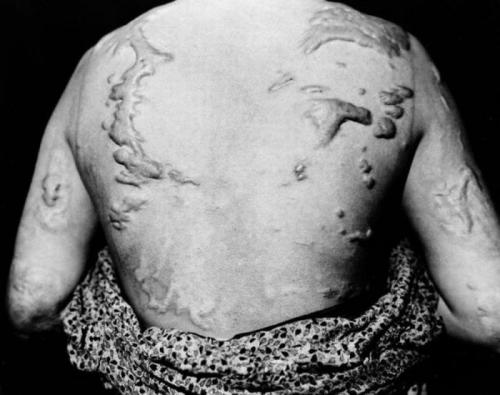 Хиросима и Нагасаки: шокирующие кадры