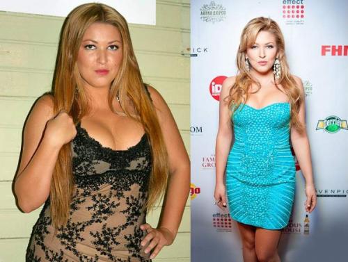 Российские знаменитости, бывшие в прошлом "толстушками"