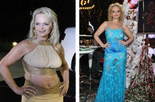 Российские знаменитости, бывшие в прошлом "толстушками"