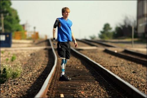 10 людей-киборгов, живущих уже сегодня