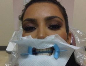 Звезды на приеме у стоматолога