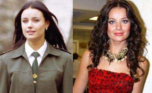 Российские знаменитости до и после пластических операций