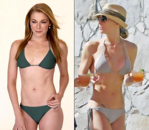 Пластические операции звезд: кто не желает рассказывать об этом?