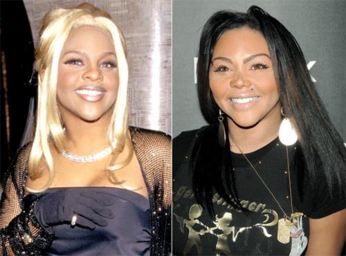 Пластические операции звезд: кто не желает рассказывать об этом?