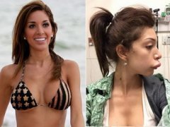 Пластические операции звезд: кто не желает рассказывать об этом?