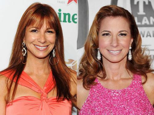 Пластические операции звезд: кто не желает рассказывать об этом?