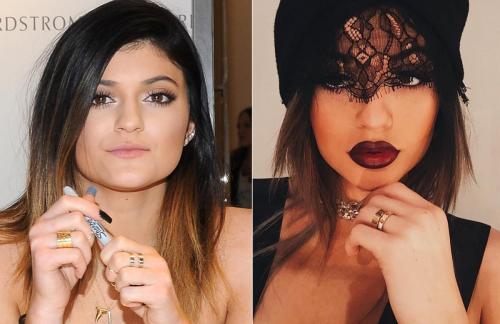 Пластические операции звезд: кто не желает рассказывать об этом?