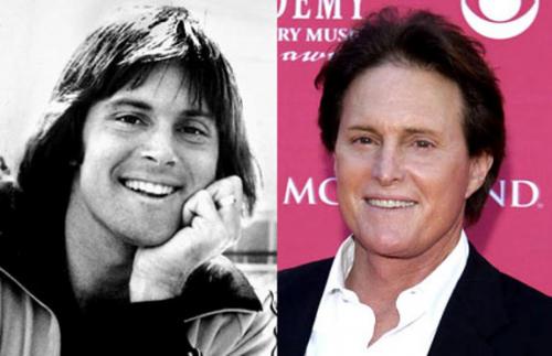 Пластические операции звезд: кто не желает рассказывать об этом?