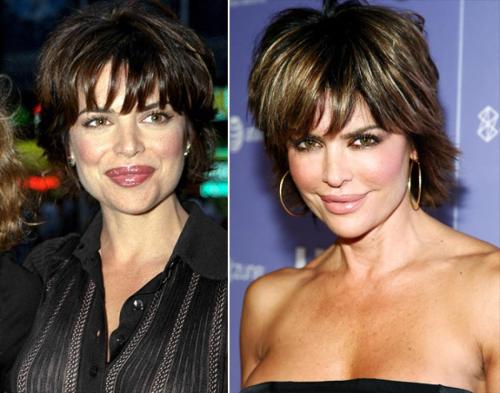 Пластические операции звезд: кто не желает рассказывать об этом?