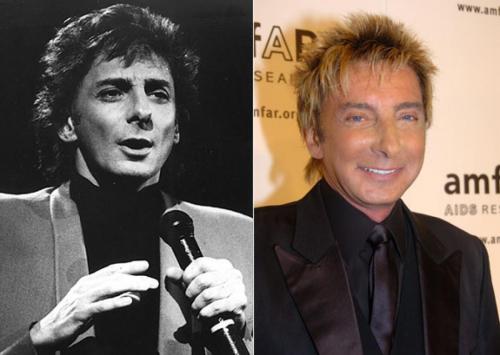 Пластические операции звезд: кто не желает рассказывать об этом?