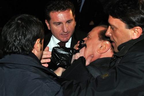 Сильвио Берлускони сломали нос и выбили два зуба в центре Милана