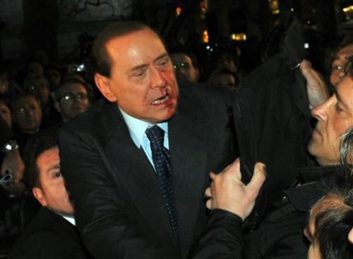 Сильвио Берлускони сломали нос и выбили два зуба в центре Милана