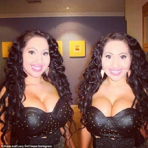 Близняшки, потратившие сотни тысяч долларов на пластику, решили родить от одного мужчины