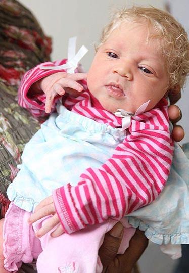 У чернокожих родителей родилась голубоглазая блондинка