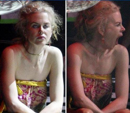 Неудачные фото звезд, которые они не хотели бы видеть в Сети