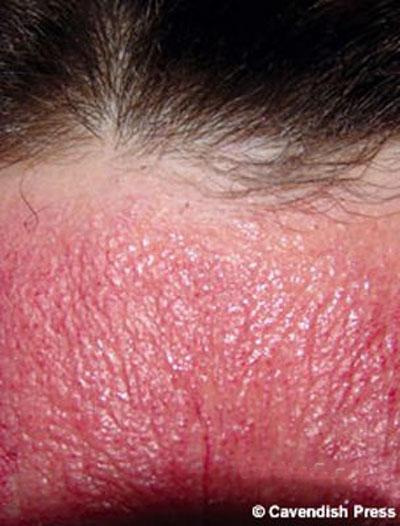 Люди с самыми нелепыми болезнями