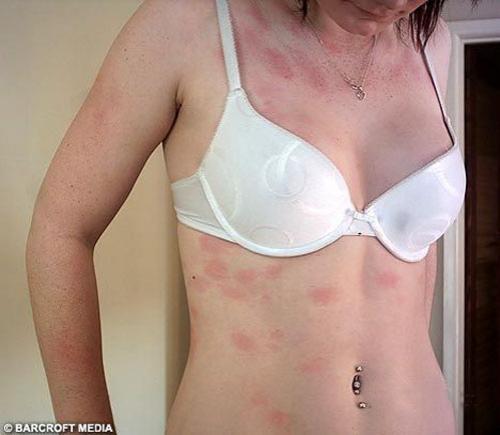 Люди с самыми нелепыми болезнями