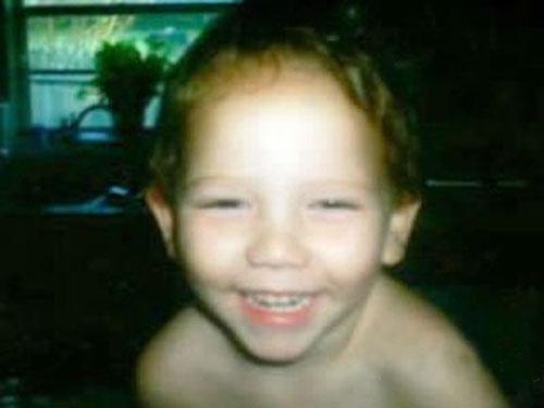 Люди с самыми нелепыми болезнями