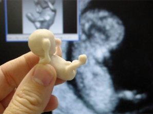 Новая технология позволяет будущим матерям подержать в руках неродившегося ребенка