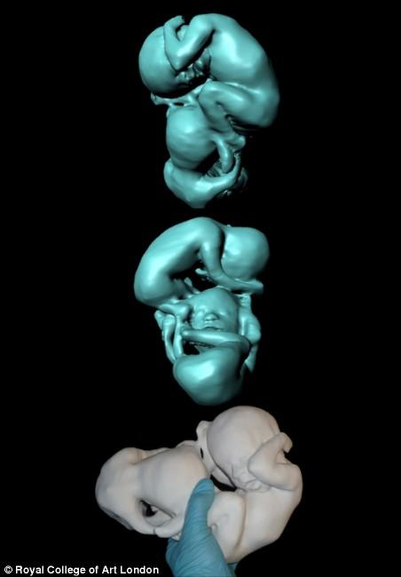 Новая технология позволяет будущим матерям подержать в руках неродившегося ребенка