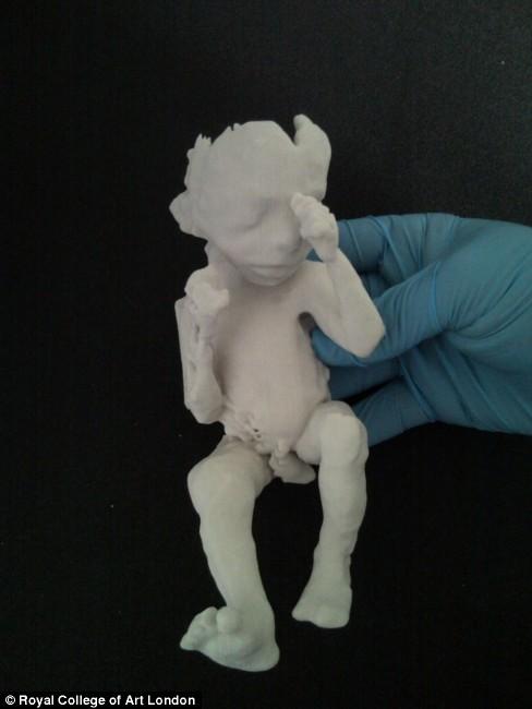 Новая технология позволяет будущим матерям подержать в руках неродившегося ребенка