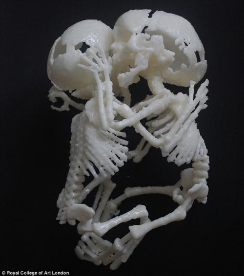 Новая технология позволяет будущим матерям подержать в руках неродившегося ребенка