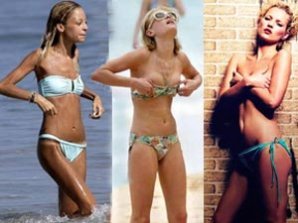 Звёзды-анорексички: кожа да кости