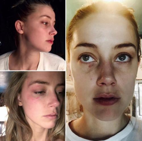 Бес в ребро: самые известные неравные браки мировых звезд