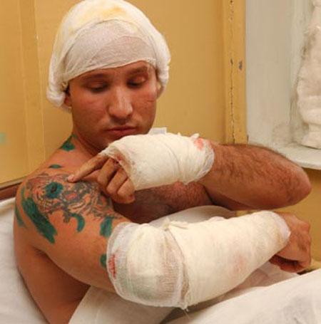 Цирковые трагедии: как звери калечат дрессировщиков