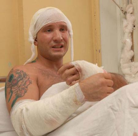 Цирковые трагедии: как звери калечат дрессировщиков